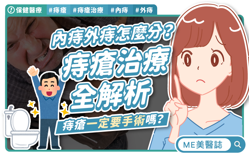 痔瘡不用再忍痛！告別「坐立難安」