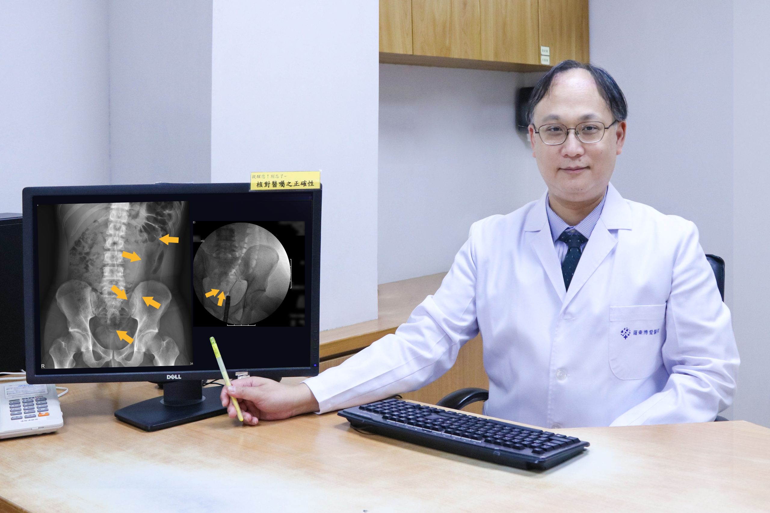 男子按摩棒深嵌乙狀結腸　醫師靠內視鏡成功自肛門取出
