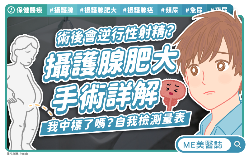 50 歲男性最怕的癌症之一！PSA 要怎麼測？醫師給答案