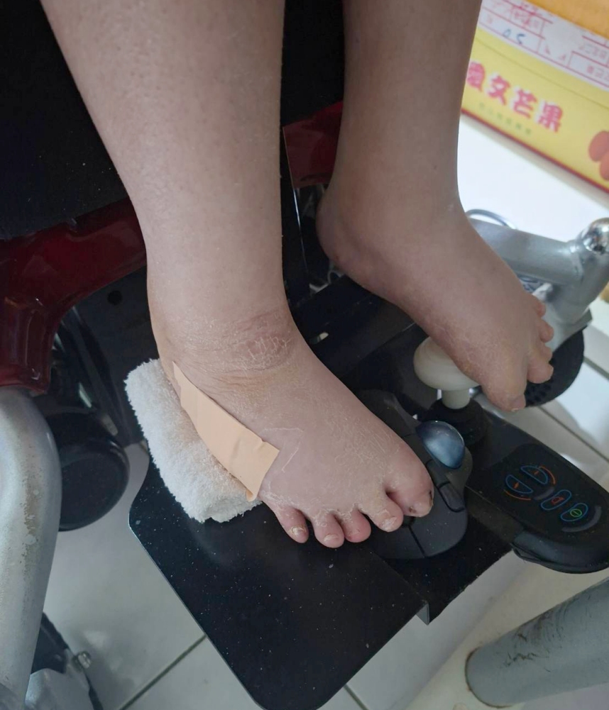 「新生命資訊」打造友善職場 黃瀅芝「輪」出新人生 4 02%E9%BB%83%E7%80%85%E8%8A%9D%E7%9A%84%E4%BD%9C%E6%A5%AD%E9%80%9A%E5%B8%B8%E5%9C%A8%E9%9B%BB%E8%85%A6%E5%89%8D%E4%BB%A5%E8%85%B3%E6%93%8D%E4%BD%9C%E6%BB%91%E9%BC%A0%E8%88%87%E9%8D%B5%E7%9B%A4%E5%AE%8C%E6%88%90%E4%BC%81%E7%95%AB