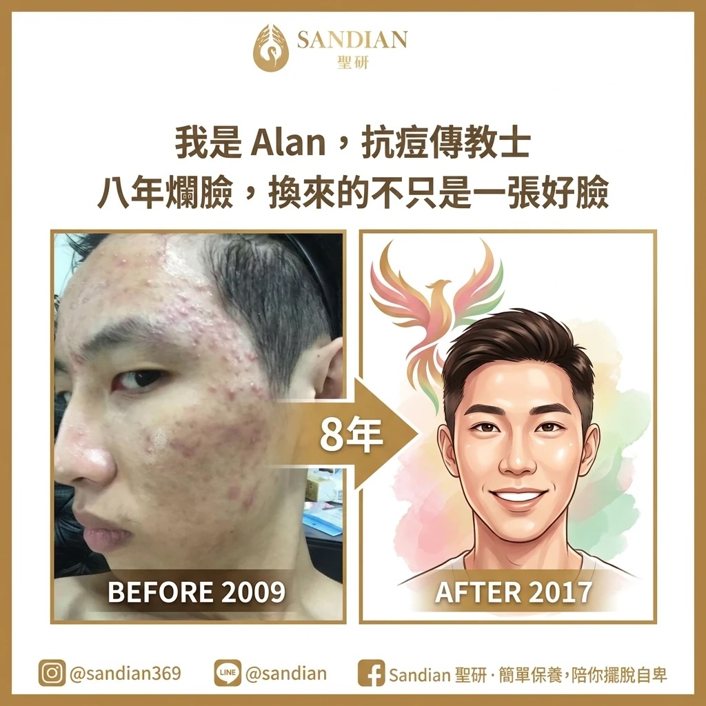 Alan 抗痘傳教士